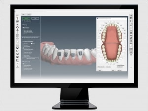 Orthoselect