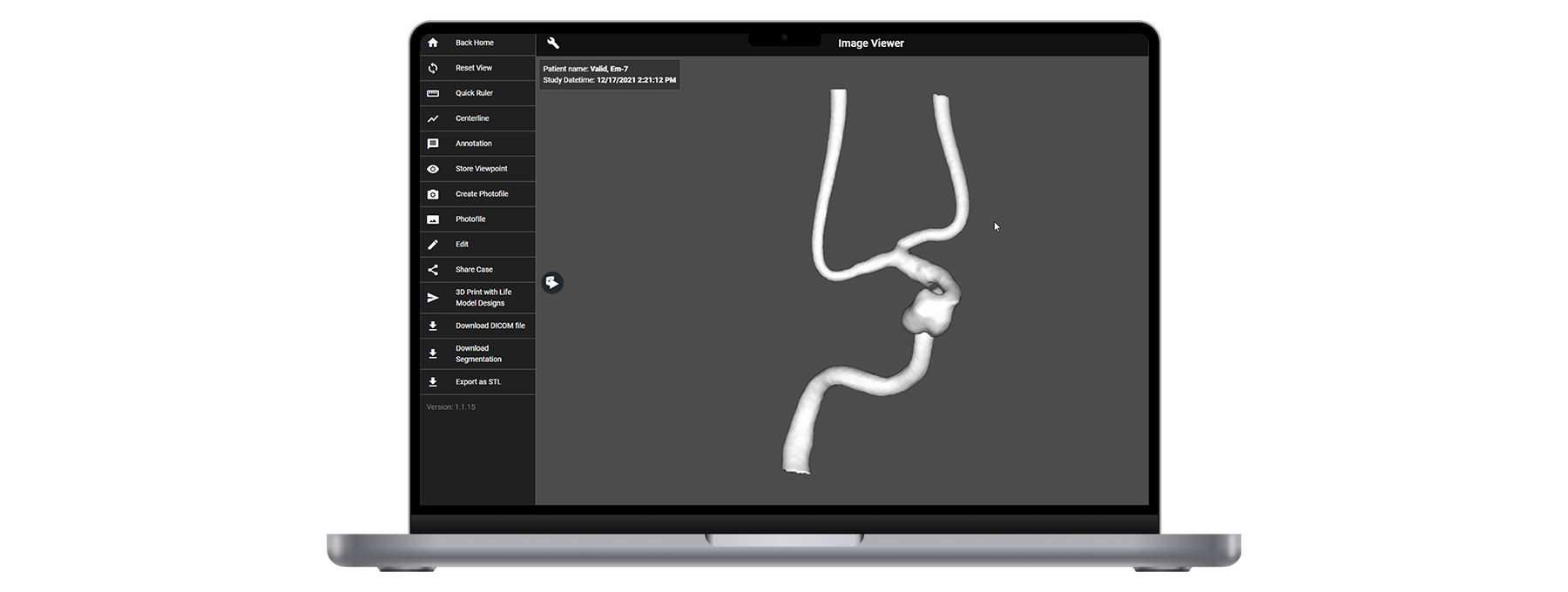 AngioCloud_Scopic_solution